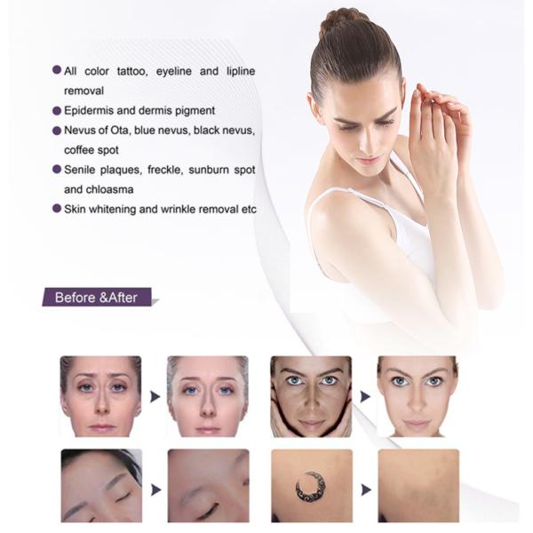 Pico Second Yag Laser Tattoo Removal Machine Skin Rejuvenation Machine