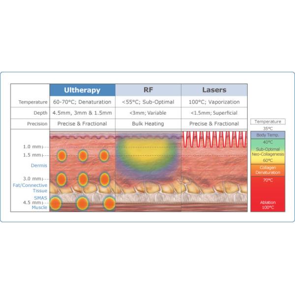 CE offer korea hifu doublo 3d face lift cartridge hifu ultrasound skin tighten machine on sale