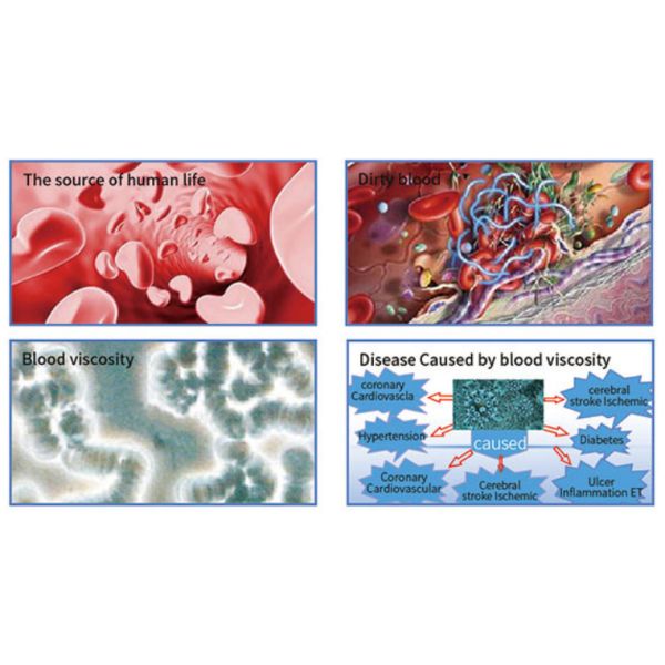 SSCH / Suyzeko Red Blue 450nm 660nm Laser Watch Diabetes Blood Viscosity Improving