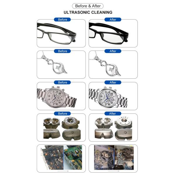 5L Ultrasonic Cleaner Machine Stainless Steel Digital Dental Instrument Ultrasonic Cleaner