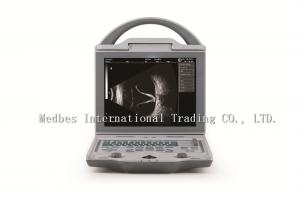Cheap Double probe sockets Full digital A/B scan portable cheapest Ophthalmic Ultrasound for sale
