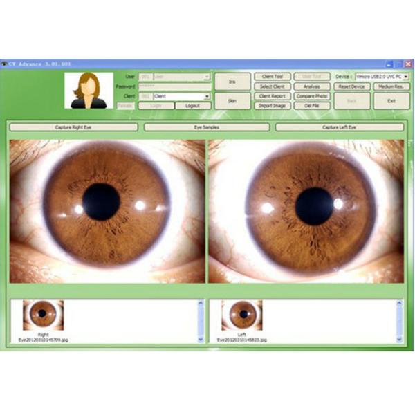 5.0 Mega pixels high resolution Multi-function iris scanner with Aluminum Box package