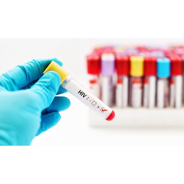 3Min HIV Rapid Test Kit