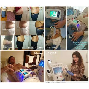 Buy cheap Body Weight Loss Sculpting Slimming Freeze Fat 4 handles cryolipolysis body from wholesalers