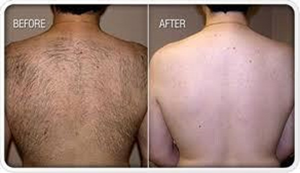 NUBWAY 2019 hot sale professional beauty salon use portable mini diode laser 808nm hair removal machine